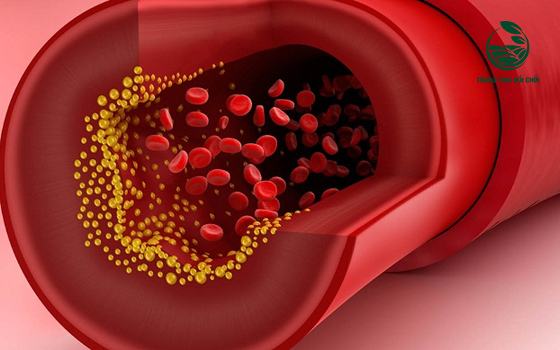 Lecithin trong trứng có khả năng loại bỏ cholesterol xấu