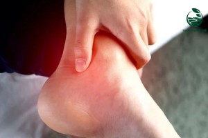 Người bệnh gout có ăn được trứng gà không? Lưu ý cách ăn đúng