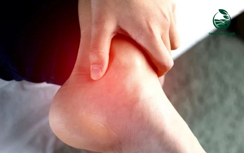 Người bệnh gout có ăn được trứng gà không? Lưu ý cách ăn đúng